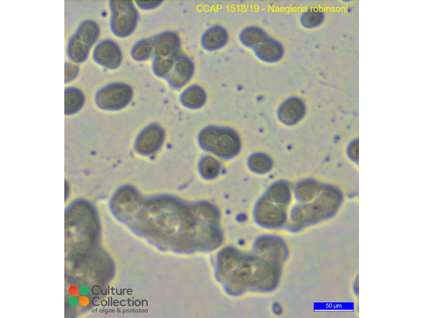 Naegleria robinsoni