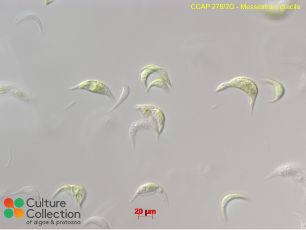 Messastrum gracile