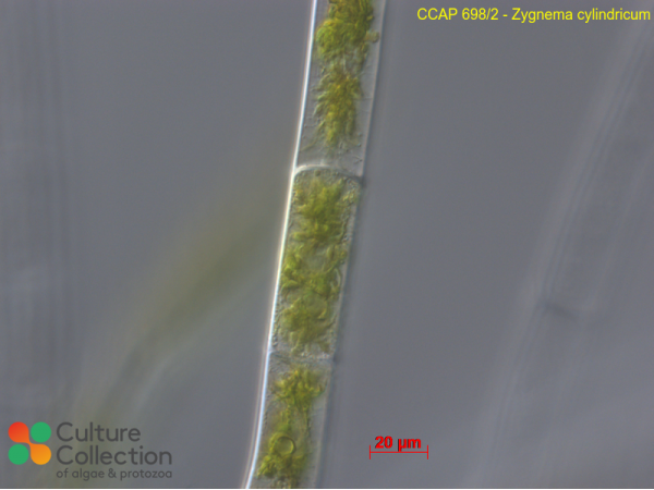 Zygnema cylindricum Zygnema cylindricum