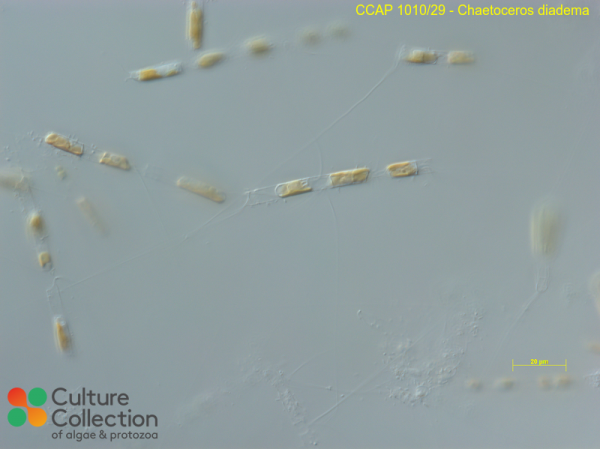 Chaetoceros diadema