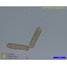 Synedropsis cf. recta