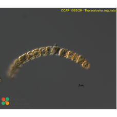 Thalassiosira angulata