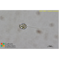 Vorticella microstoma