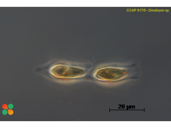 Dinobryon sp.