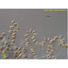 Asterionellopsis sp.