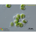Botryococcus braunii