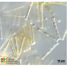 Asterionella formosa