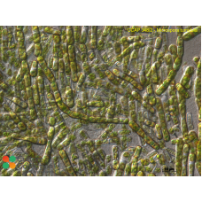 Microspora tumidula