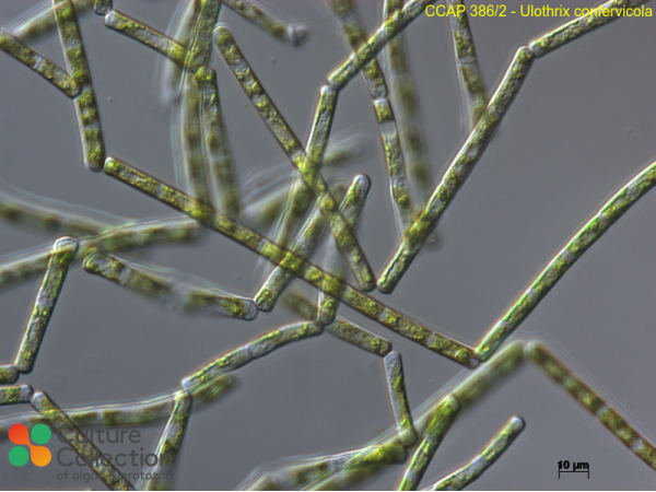 Ulothrix confervicola