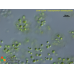 Dictyosphaerium ehrenbergianum