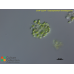 Dictyosphaerium ehrenbergianum