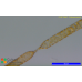Proboscia inermis