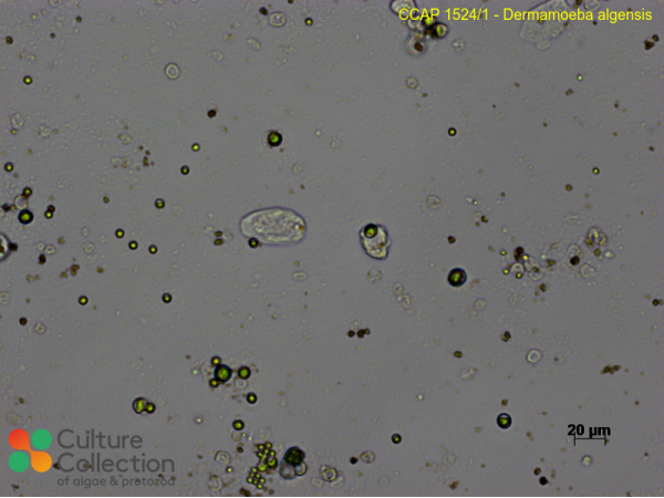 Dermamoeba algensis
