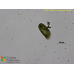 Paramecium bursaria