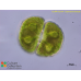 Cosmarium botrytis