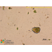 Rhizaspis rugosus var. transforma