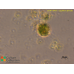 Lecythium jennyae