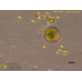 Lecythium jennyae