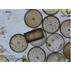 Coscinodiscus wailesii