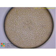 Coscinodiscus wailesii