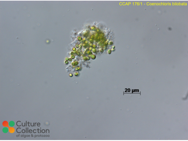 Radiococcus bilobatus