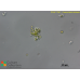 Radiococcus bilobatus