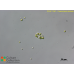 Radiococcus bilobatus