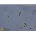 Chlorella vulgaris Chlorella vulgaris