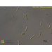 Stichococcus bacillaris