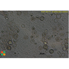 Acanthamoeba castellanii  