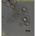 Acanthamoeba castellanii  