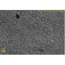 Acanthamoeba castellanii  