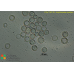 Acanthamoeba castellanii  