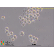 Acanthamoeba hatchetti