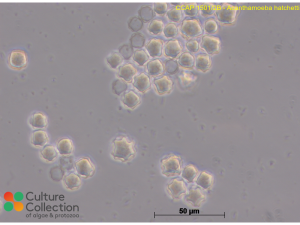 Acanthamoeba hatchetti