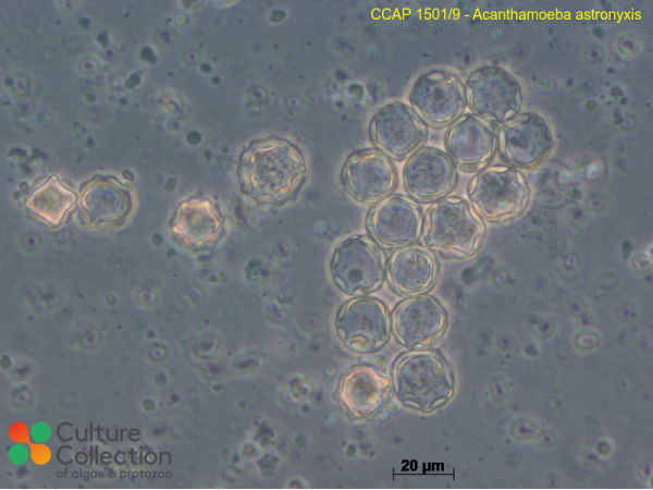 Acanthamoeba astronyxis