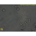 Acanthamoeba castellanii  