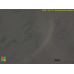 Acanthamoeba castellanii  