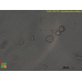 Acanthamoeba castellanii  