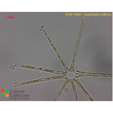 Zygorhizidium affluens