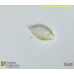 Mallomonas caudata