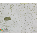Paramecium bursaria