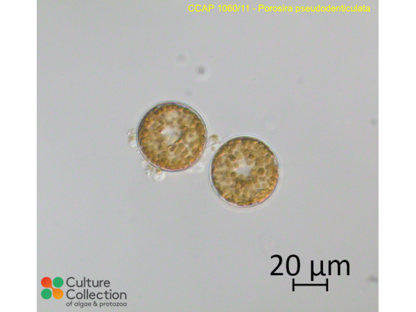 Porosira pseudodenticulata