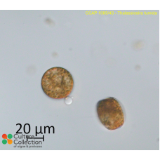 Thalassiosira tumida