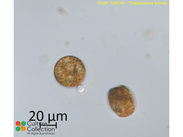 Thalassiosira tumida