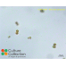 Microcystis aeruginosa