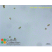 Microcystis aeruginosa