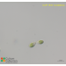 Dunaliella sp.