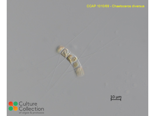 Chaetoceros diversus