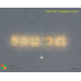 Bacteriastrum hyalinum